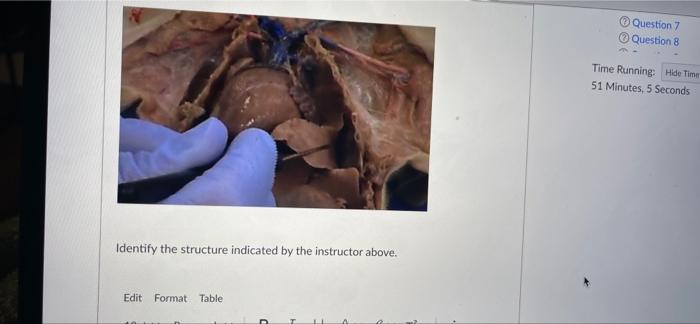 Question 7 Question 8 Time Running Hide Time 51 Minutes 5 Seconds Identify The Structure Indicated By The Instructor Ab 1