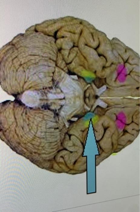 Which Part Of The Brain Is This In Blue 1