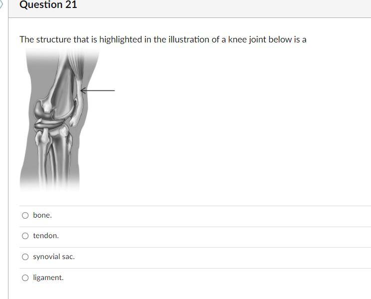 Question 21 The Structure That Is Highlighted In The Illustration Of A Knee Joint Below Is A Bone Tendon O Synovial Sa 1