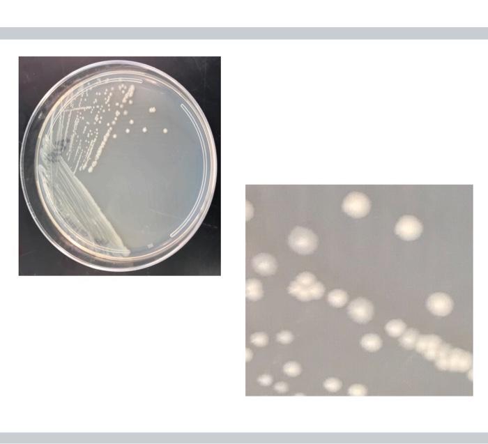 Instructions 1 Samples From An Ill Patient Were Collected By A Physician For Testing A Bacterial Infection Is Suspecte 1