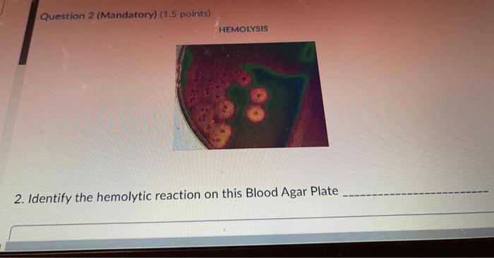 Question 2 Mandatory 1 5 Points Hemolysis 2 Identify The Hemolytic Reaction On This Blood Agar Plate 1
