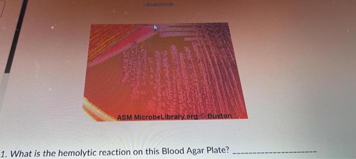 Sc Asm Microbelibrary Org Buxton 1 What Is The Hemolytic Reaction On This Blood Agar Plate 1