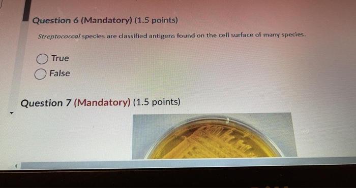 Question 6 Mandatory 1 5 Points Streptococcal Species Are Classified Antigens Found On The Cell Surface Of Many Spec 1