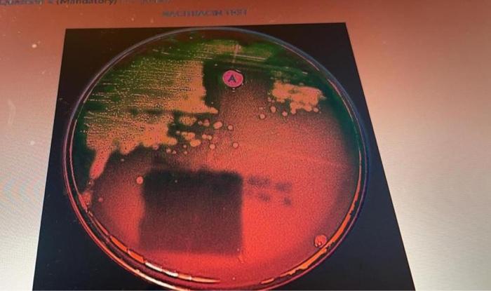Based On The Observations With Hemolytic Activity And Bacitracin Test Identify The Genus And Species Of Bacteria Most L 1