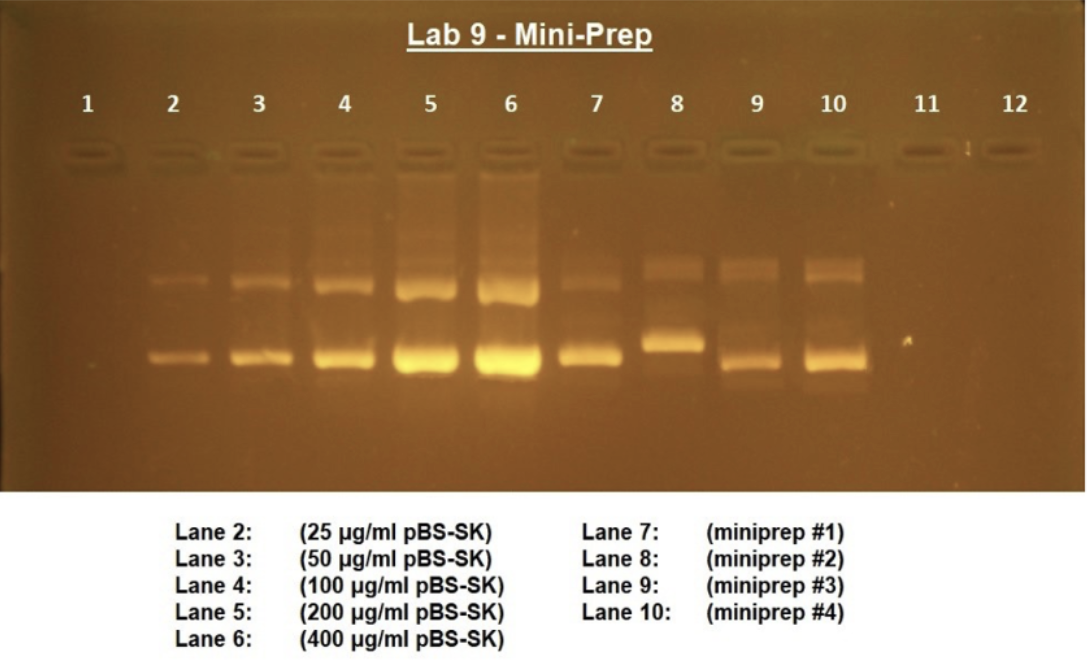 Lab 9 Mini Prep 1 2 3 4 5 6 7 8 9 10 11 12 Lane 2 Lane 3 Lane 4 Lane 5 Lane 6 25 Pg Ml Pbs Sk 50 Pg Ml Pbs Sk 1