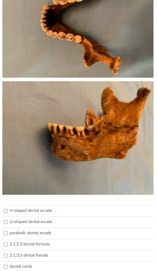 V Shaped Dental Arcade U Shaped Dental Arcade Parabolic Dental Arcade 2 1 2 3 Dental Formula 2 1 3 3 Dental Fomula Denta 1