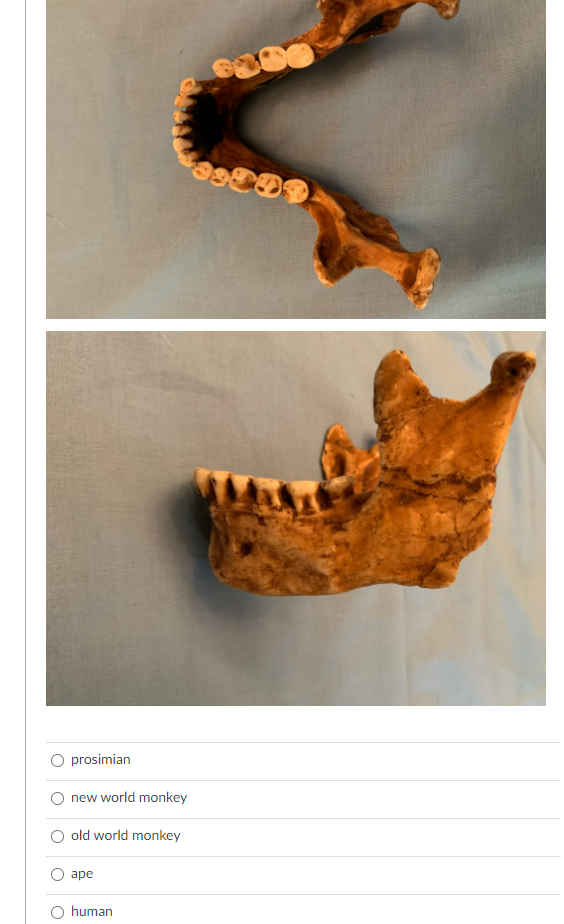 V Shaped Dental Arcade U Shaped Dental Arcade Parabolic Dental Arcade 2 1 2 3 Dental Formula 2 1 3 3 Dental Fomula Denta 2