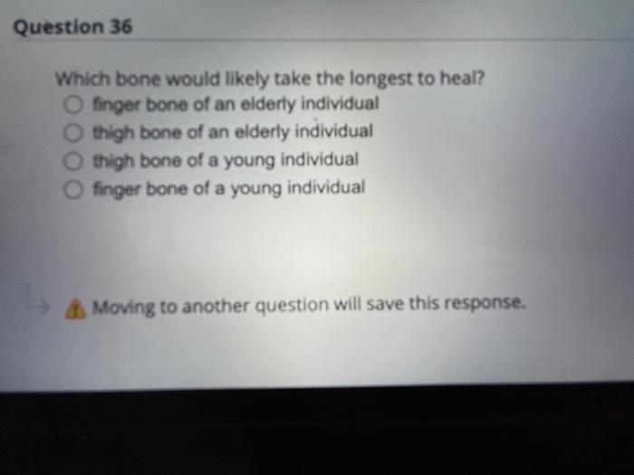 Sponse Question 38 Norepinephrine Releasing Fibers Are Called Cholinergic Fibers O True False Moving To Another Questio 3