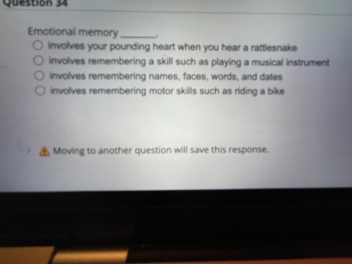 Sponse Question 38 Norepinephrine Releasing Fibers Are Called Cholinergic Fibers O True False Moving To Another Questio 4