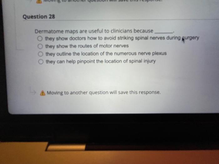 Question 31 The Action Potential Is Caused By Permeability Changes In The Plasma Membrane True False Moving To Another 3