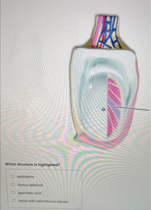 Which Structure Is Highlighted O Epididymis O Ductus Deferens Spermatic Cord Lobule With Seminiferous Tubules 1