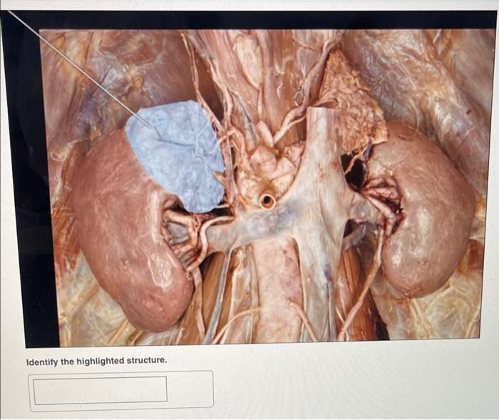 Identify The Highlighted Structure 1