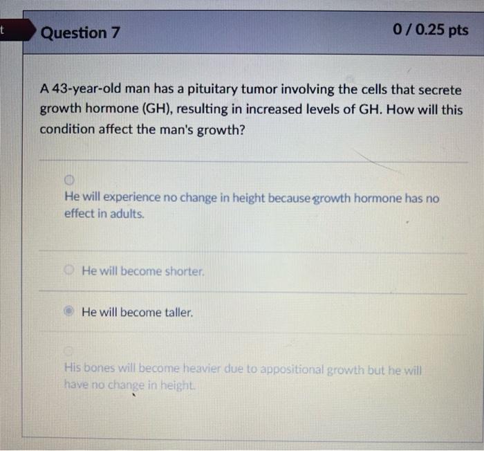 Rect Question 6 0 0 25 Pts Which Statement Best Explains Why Petite Body Size Is A Risk Factor For Osteoporosis A Petit 2