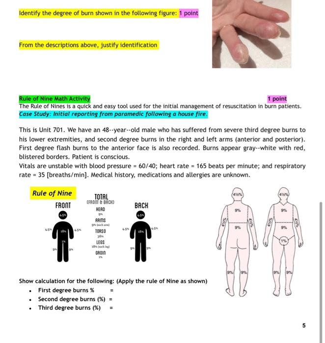 Identify The Degree Of Burn Shown In The Following Figure 1 Point From The Descriptions Above Justify Identification R 1