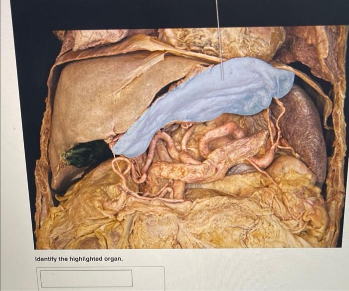 Identify The Highlighted Organ Identify The Highlighted Structure Identify The Highlighted Structure Identify T 1
