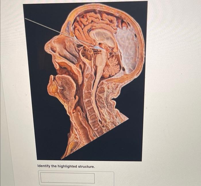 Identify The Highlighted Organ Identify The Highlighted Structure Identify The Highlighted Structure Identify T 2