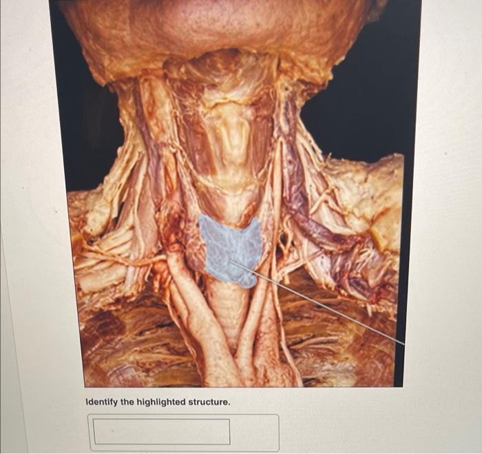 Identify The Highlighted Organ Identify The Highlighted Structure Identify The Highlighted Structure Identify T 3