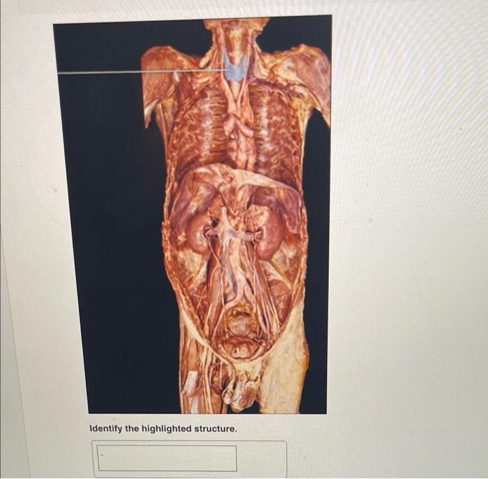 Identify The Highlighted Organ Identify The Highlighted Structure Identify The Highlighted Structure Identify T 4