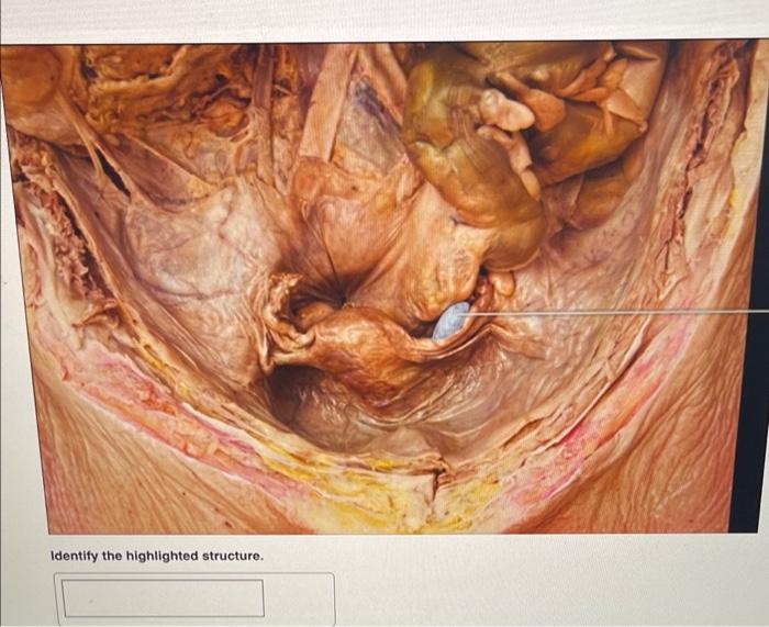Identify The Highlighted Organ Identify The Highlighted Structure Identify The Highlighted Structure Identify T 5