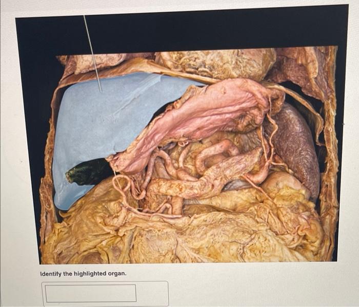 Identify The Highlighted Organ 1