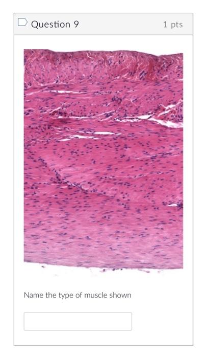Question 5 1 Pts Velta Name The Indicated Region D Question 6 1 Pts On A Bone A Shallow Indentation Is Called A Quest 3