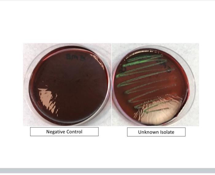 Negative Control Unknown Isolate 1
