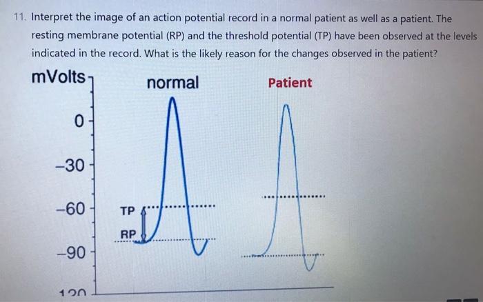 A 11 Interpret The Image Of An Action Potential Record In A Normal Patient As Well As A Patient The Resting Membrane P 1