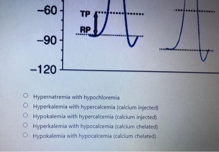 A 11 Interpret The Image Of An Action Potential Record In A Normal Patient As Well As A Patient The Resting Membrane P 2