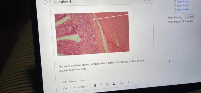 Pas Question 4 Question 6 Question Question Time Running Hide Tome 52 Minutes 39 Seconds The Layer Of Tissue Above Cont 1