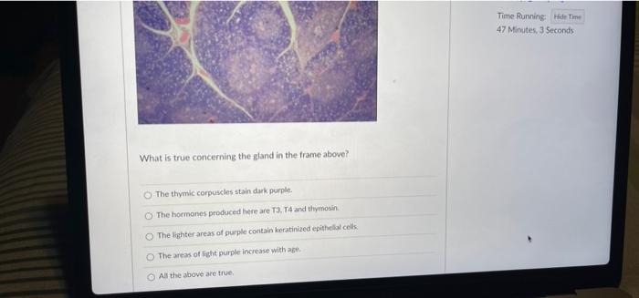Time Running Hide Time 47 Minutes 3 Seconds What Is True Concerning The Gland In The Frame Above The Thymic Corpuscle 1