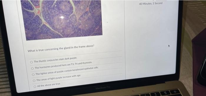 40 Minutes 1 Second What Is True Concerning The Land In The Frame Above The Thymic Corpuscles Stain Dark Purple The 1