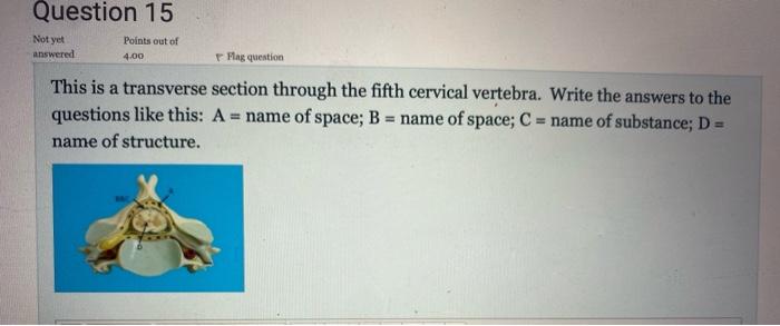 Question 15 Not Yet Answered Points Out Of 4 00 Flag Question This Is A Transverse Section Through The Fifth Cervical Ve 1