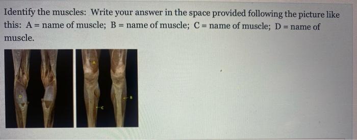 Question 15 Not Yet Answered Points Out Of 4 00 Flag Question This Is A Transverse Section Through The Fifth Cervical Ve 2