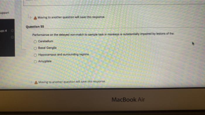 A Moving To Another Question Will Save This Response Question 33 Proprioception Refers To The Sense Of Interpreting Fac 2