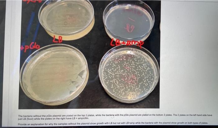 Lrs2ine Tp Glos The Bacteria Without The Pglo Plasmid Are Plated On The Top 2 Plates While The Bacteria With The Pio Pl 1