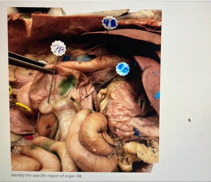 4b 70 Identify The Specific Region Of Organ 48 1