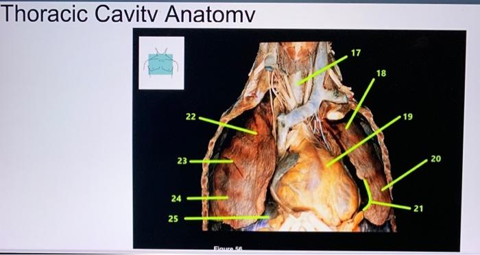 Thoracic Cavity Anatomy 17 18 22 19 23 20 24 21 25 Flow Thoracic Cavity Anatomy 26 33 32 31 27 30 28 29 1