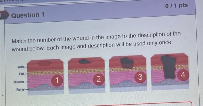011 Pts Question 1 Match The Number Of The Wound In The Image To The Description Of The Wound Below Each Image And Desc 1