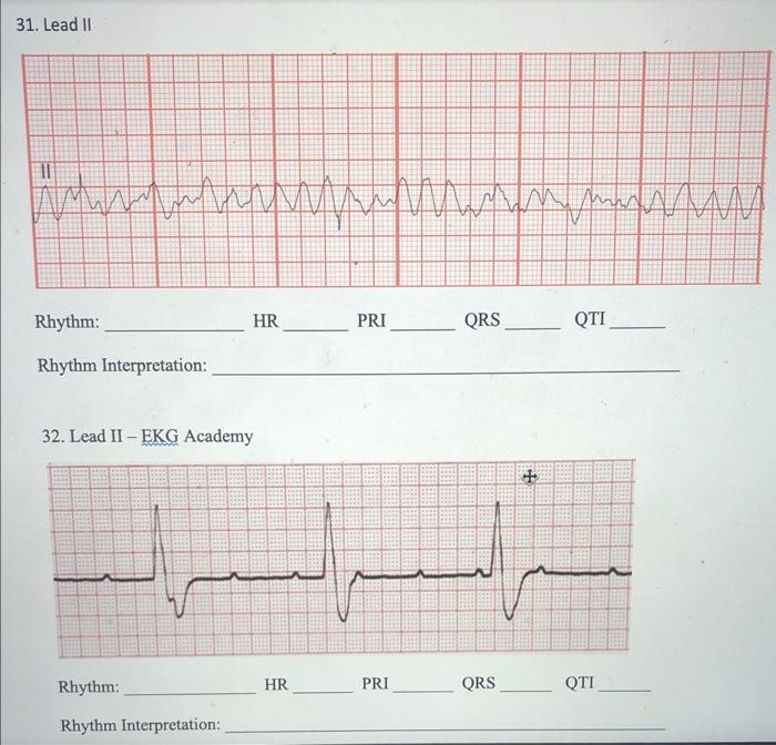 31 Lead Ii Www Rhythm Rhythm Interpretation 32 Lead Ii Ekg Academy Rhythm Rhythm Interpretation Hr Hr Pri Pri Mmmm 1