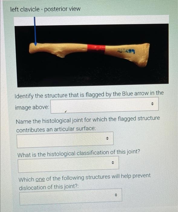 Left Clavicle Posterior View 489 Identify The Structure That Is Flagged By The Blue Arrow In The Image Above Name The 1
