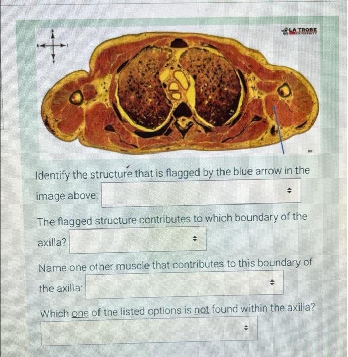 La Trobe Weit Identify The Structure That Is Flagged By The Blue Arrow In The Image Above The Flagged Structure Contr 1