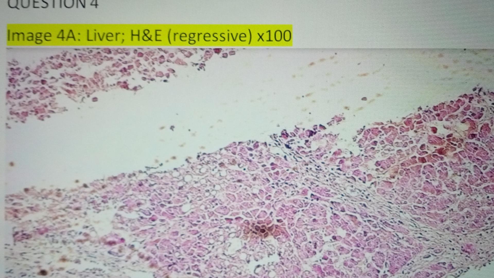 Image 4a Liver H E Regressive X100 1