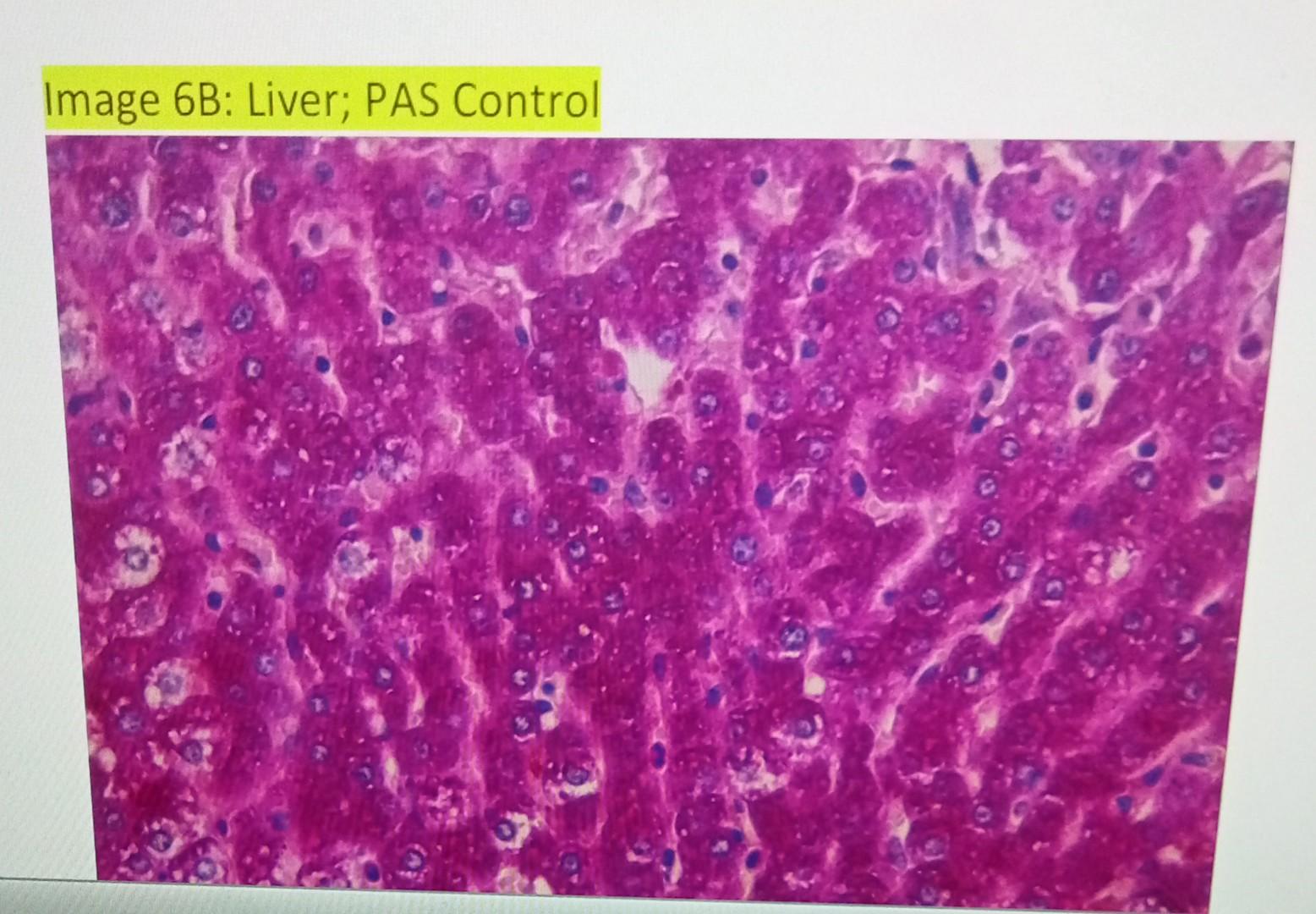 Image 6b Liver Pas Control Image 6b Liver Pas Control Kidney Pas X400 2