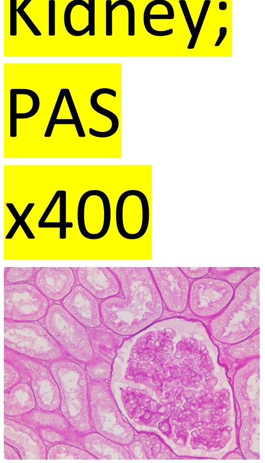 Image 6b Liver Pas Control Image 6b Liver Pas Control Kidney Pas X400 3