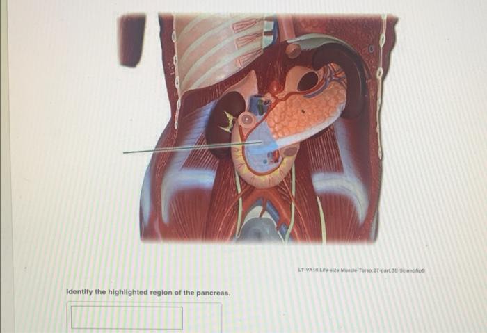 Ltvaselimusche Two Atgart Doc Identify The Highlighted Region Of The Pancreas 1