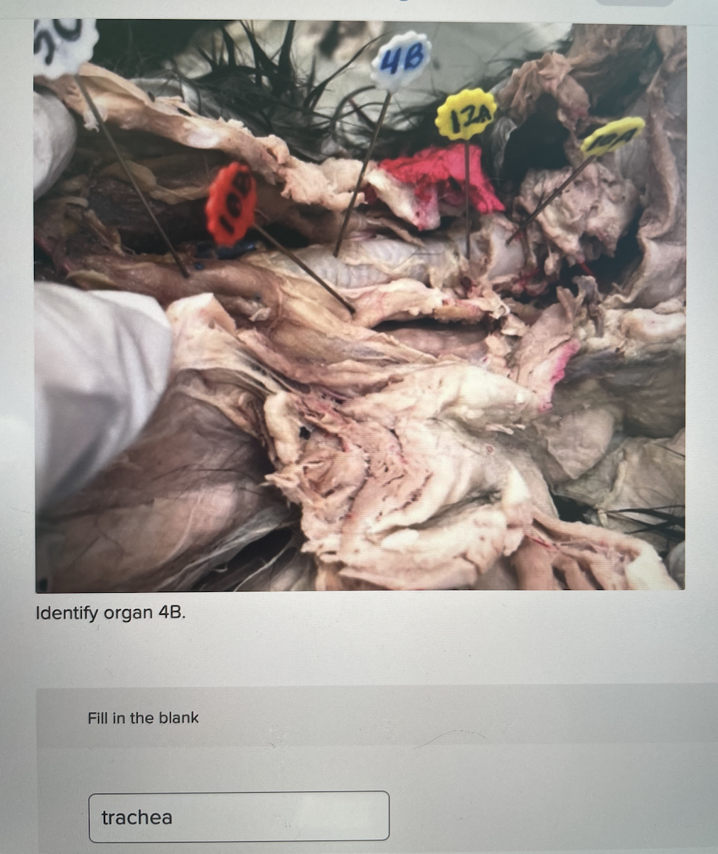 4b Iza Identify Organ 4b Fill In The Blank Trachea 1