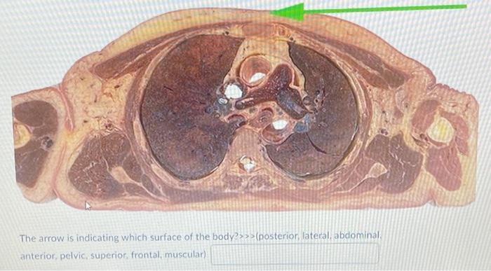 The Arrow Is Indicating Which Surface Of The Body Posterior Lateral Abdominal Anterior Pelvic Superior Frontal 1