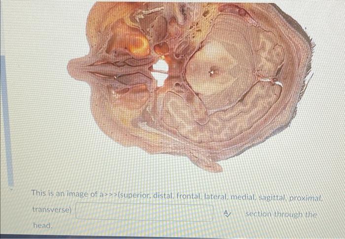 This Is An Image Of A Lateral Inferior Muscular Frontal Transverse Yumban Superior Mediastinal A Section Through 2