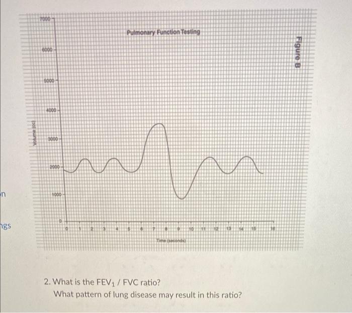 Too Pulmonary Function Testing 8000 Figure B 5000 4000 3000 Urn 2000 N 1000 Ngs 10 11 Tund 2 What Is The Fev1 Fvc Ratio 1