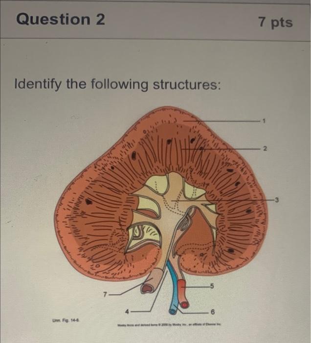 Question 2 Identify The Following Structures Unn Fig 14 6 2011 7 Y M 7 Pts 2 5 6 1 2 3 7 Choose Urethra Renal 1